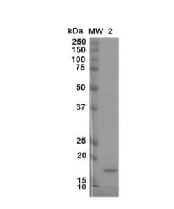 Novus Biologicals Recombinant Mouse beta-Synuclein Active, Monomer Protein 2 x 100 &mu;g Vials | Buy Online | Novus Biologicals | Fisher Scientific